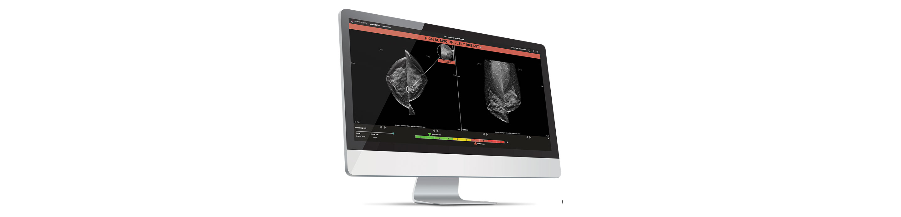 Visuel d'entête - Mammographie