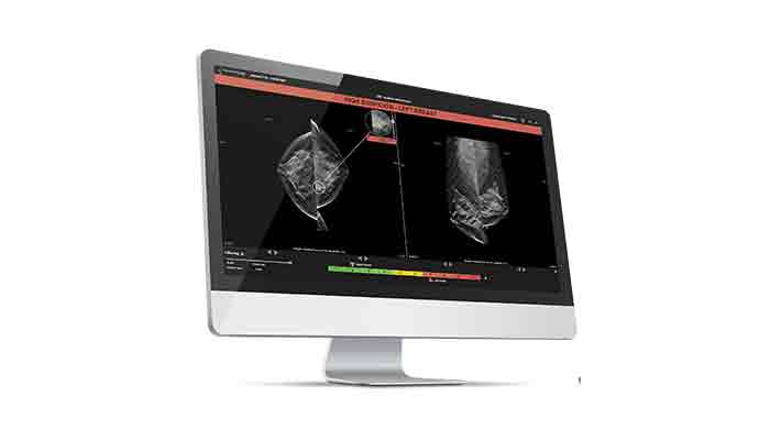 Visuel d'entête - Mammographie